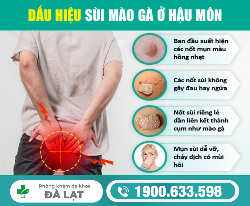 Hình ảnh minh họa